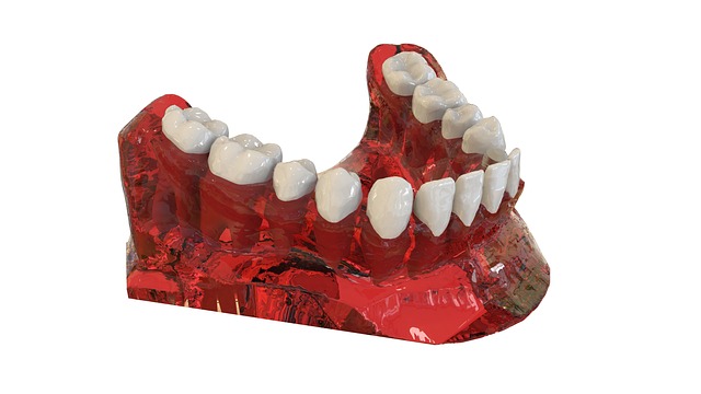 zirconium oxide dental implants