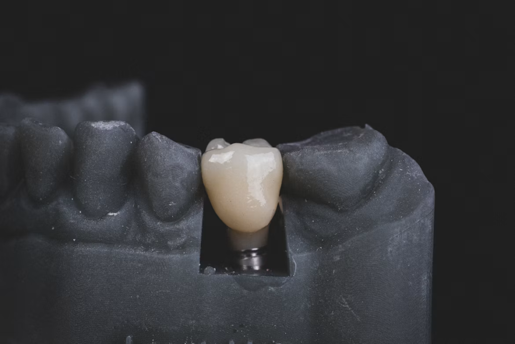 Are Implant Materials the Key to Understanding Zirconia vs Titanium Integration