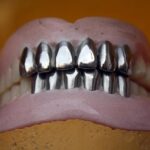 metal teeth, dental, denture, orthodontic, mouth, oral, brown teeth, dental, dental, denture, denture, denture, denture, denture, orthodontic