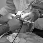 anesthesia, hospital, surgery, patient, operation, doctor, op, scalpel, teamwork, scissors, treatment, electrosurgery, biopsy, tube, healthcare, hand, outpatient, emergency, diagnosis, sickness, disease, dentistry, dental, dental care, gray hospital, gray doctors, gray emergency, gray teamwork, gray blood, gray care, gray healthcare