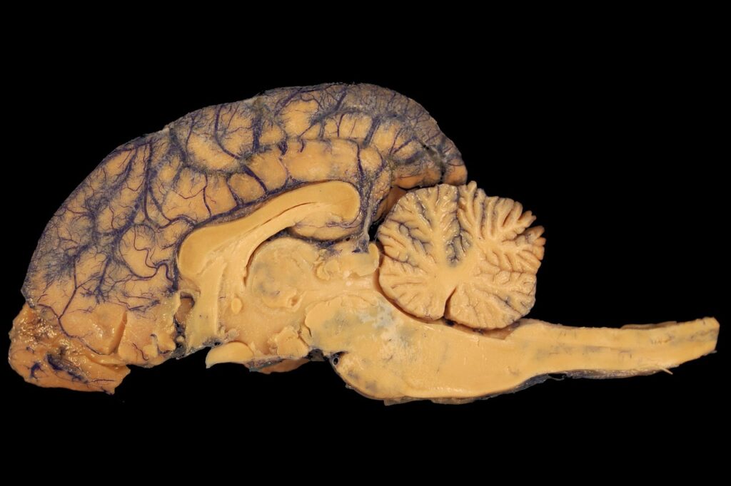 brain, anatomy, dog, paerparat, horse, nature, biology, dorsal, animal, body, veterinary medicine, cerebrum, cerebellum, brain stem, bar, corpus callosum, pet, ventricle, veins, white matter, grey matter, science