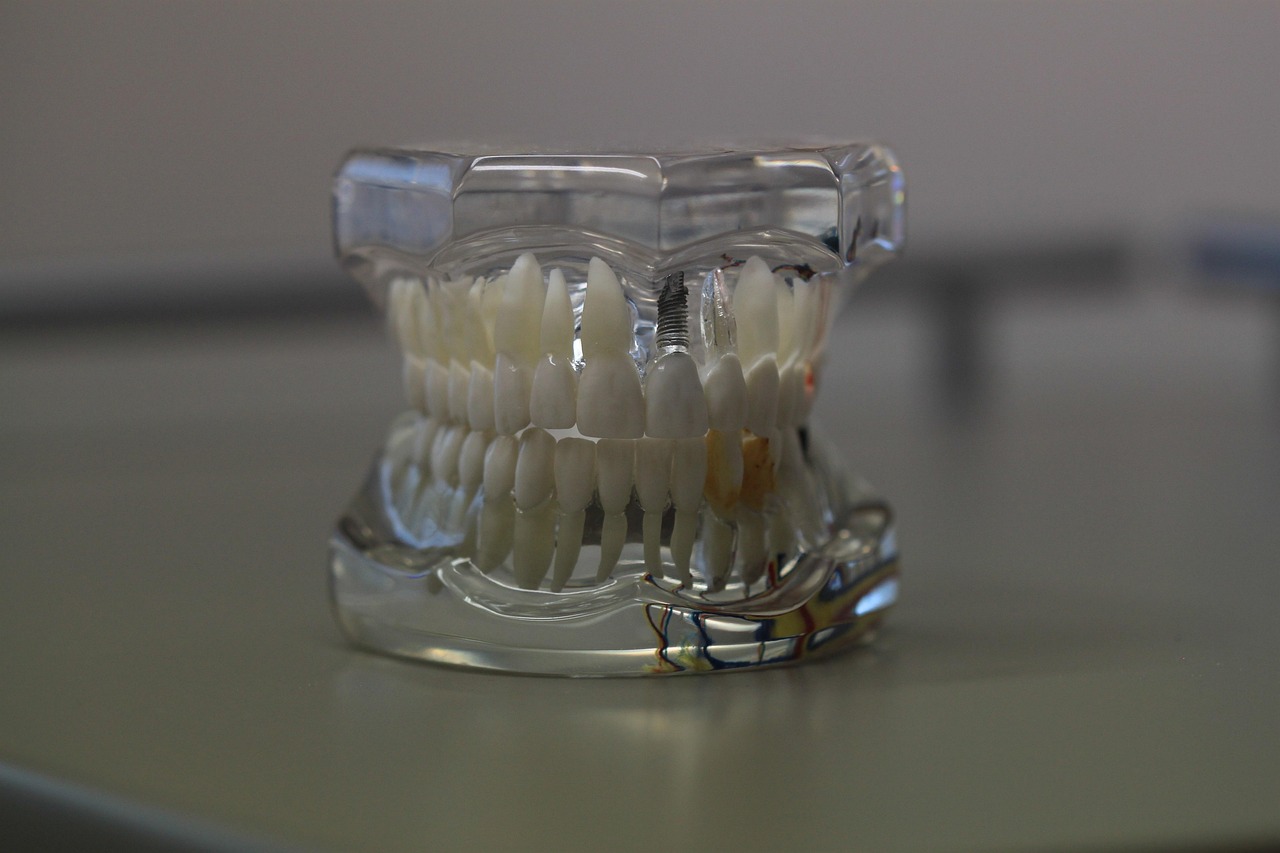 dentistry, dentals, teeth, model, jaw, tooth, healthcare, oral, care, denture, gray model, gray teeth, gray care, gray healthcare, dentistry, dentistry, jaw, tooth, tooth, tooth, tooth, tooth, oral, denture, denture