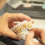 tooth replacement, dentist, healthcare, dentistry, smile, ceramic, applying, hand labor, person, clinic, equipment, brown smile, brown healthcare, dentist, dentist, dentistry, dentistry, dentistry, dentistry, dentistry