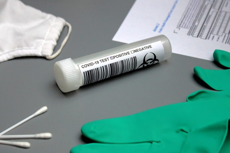 test, diagnosis, medical, medical supplies, face mask, earphones, gloves, coronavirus, covid-19, examination, test result, hotspot, risk, travel warning, second wave, restrictions, medical supplies, medical supplies, medical supplies, medical supplies, medical supplies, test result, restrictions