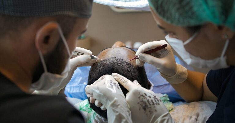 hair transplant, treatment, surgery, procedure, scalp, head, dermatology, hair transplant, hair transplant, hair transplant, hair transplant, hair transplant