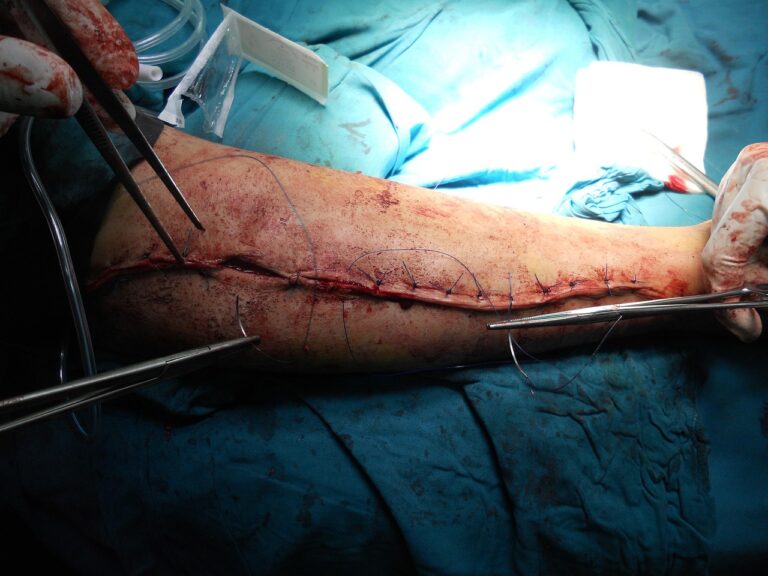 surgery, orthopedic, arm, hospital, doctor, healthcare, medicine, body, anatomy, clinic, stitched, injury, surgery, orthopedic, orthopedic, orthopedic, orthopedic, orthopedic, doctor, injury