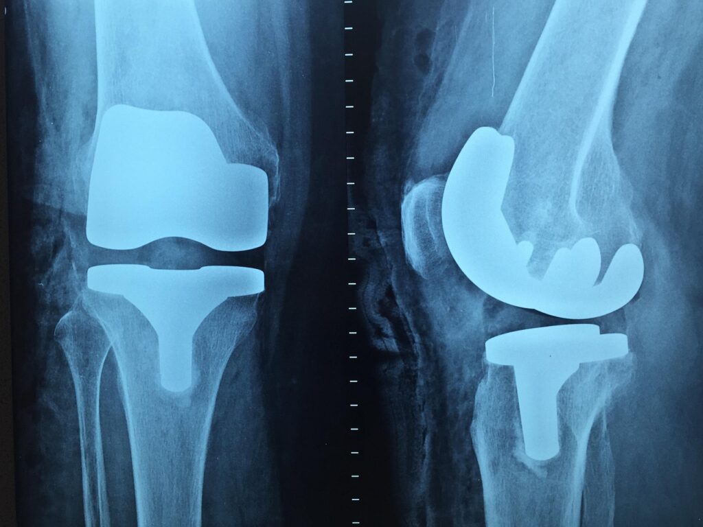 doctor, orthopedics, x-ray, knee, orthopedics, orthopedics, orthopedics, orthopedics, x-ray, x-ray, x-ray, x-ray, x-ray, knee, knee, knee, knee