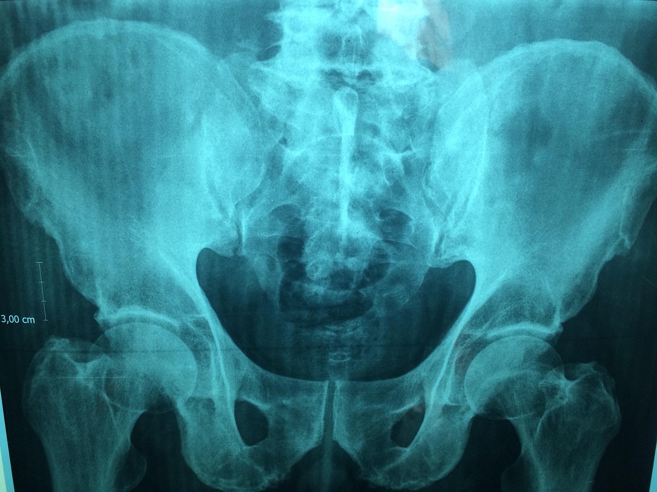 doctor, x ray, hospital, physician, scan, film, examination, diagnosis, bone, radiology, x ray, x ray, x ray, x ray, radiology, radiology, radiology, radiology, radiology