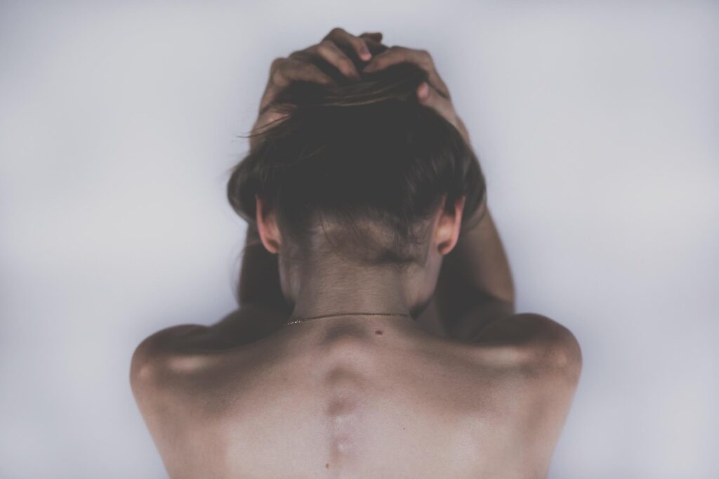 woman, sad, depression, skin, headache, aching, body, sad girl, spine, shoulders, back, hair, pain, girl, female