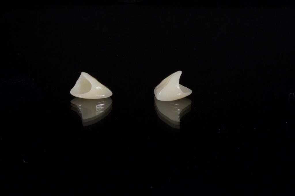 dental, porcelain tooth, wax, dental, dental, dental, dental, dental