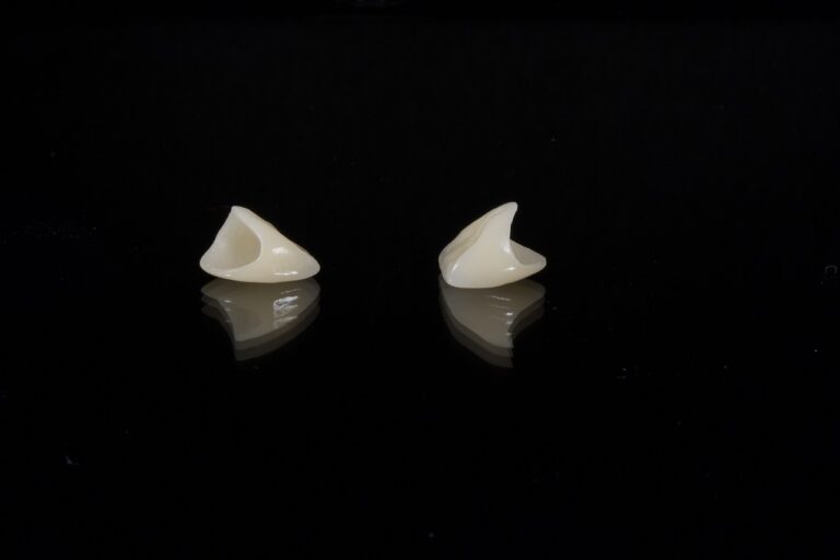 dental, porcelain tooth, wax, dental, dental, dental, dental, dental