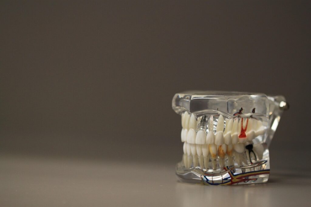 dentistry, dentals, teeth, model, jaw, oral, care, tooth, brown model, brown teeth, brown care, dentistry, dentistry, teeth, teeth, tooth, tooth, tooth, tooth, tooth