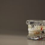 dentistry, dentals, teeth, model, jaw, oral, care, tooth, brown model, brown teeth, brown care, dentistry, dentistry, teeth, teeth, tooth, tooth, tooth, tooth, tooth