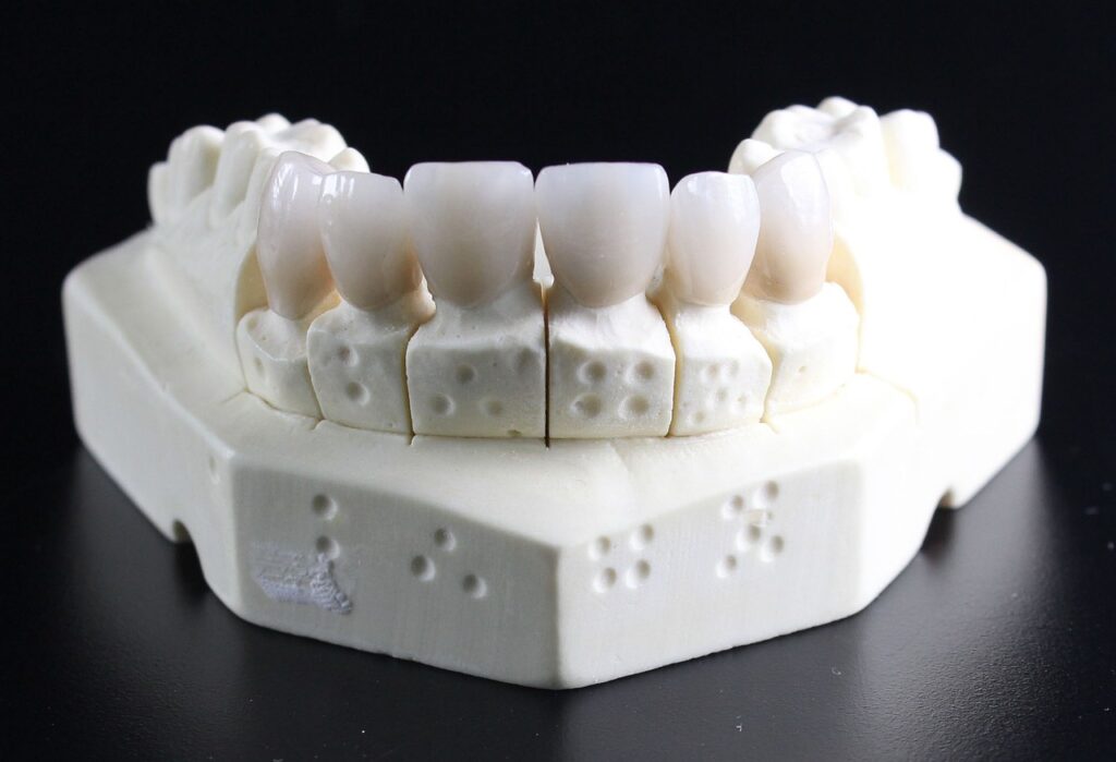 dentures, teeth, dental technician, teeth, teeth, teeth, teeth, teeth