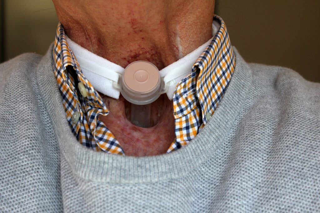 disability, laryngectomy, surgery, stoma, larynx, surgical, trachea, esophagus, vocal cords, web header, banner, cancer, respiratory, throat, patient, neck breather, tracheostomy, tracheotomy, windpipe, tube, operation procedure, hospital, medical, illness, cancer, cancer, cancer, cancer, cancer, throat, throat, tracheostomy, tracheostomy