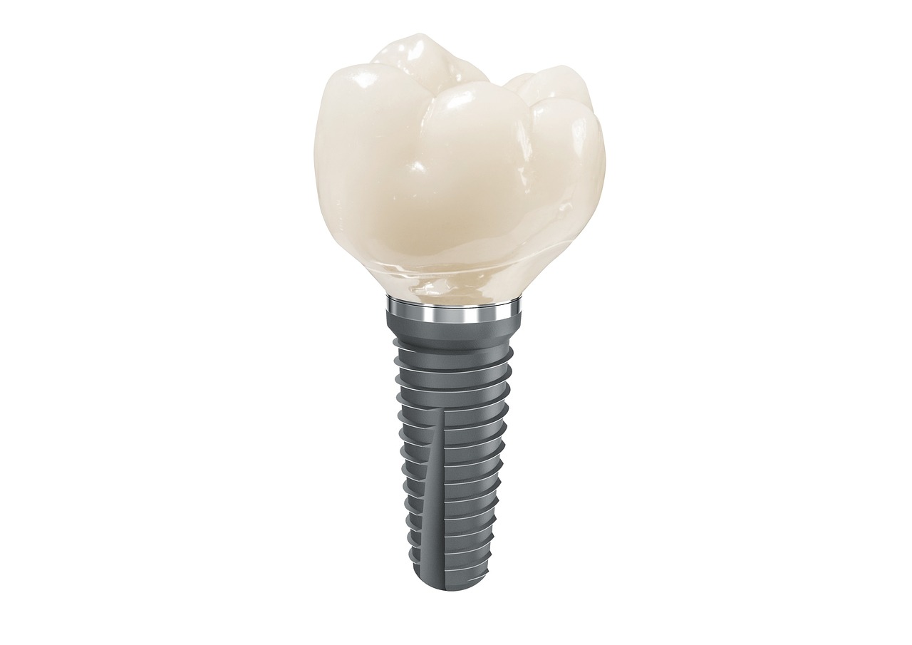 cerec, made, for u, cerec, cerec, cerec, cerec, cerec