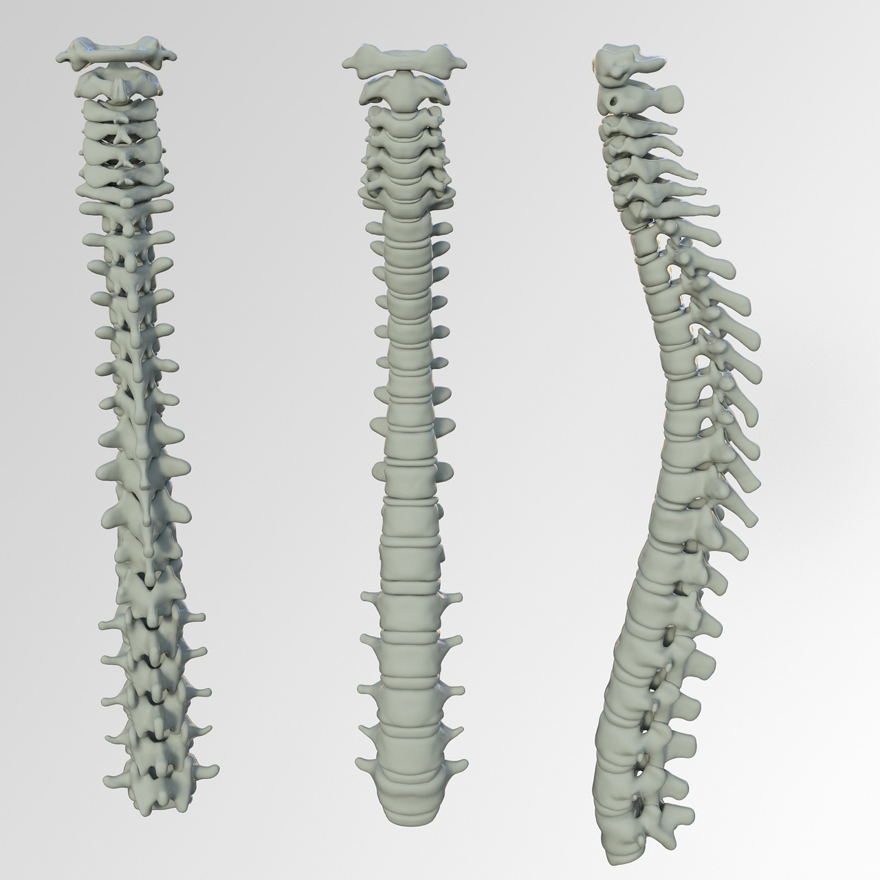 spine, bone, back pain, vertebrae, band washers, disc prolapse, anatomy, human, cross, the back, backbone, spine, spine, spine, spine, spine, bone, back pain, backbone